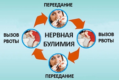 Лечение булимии в Дубровке